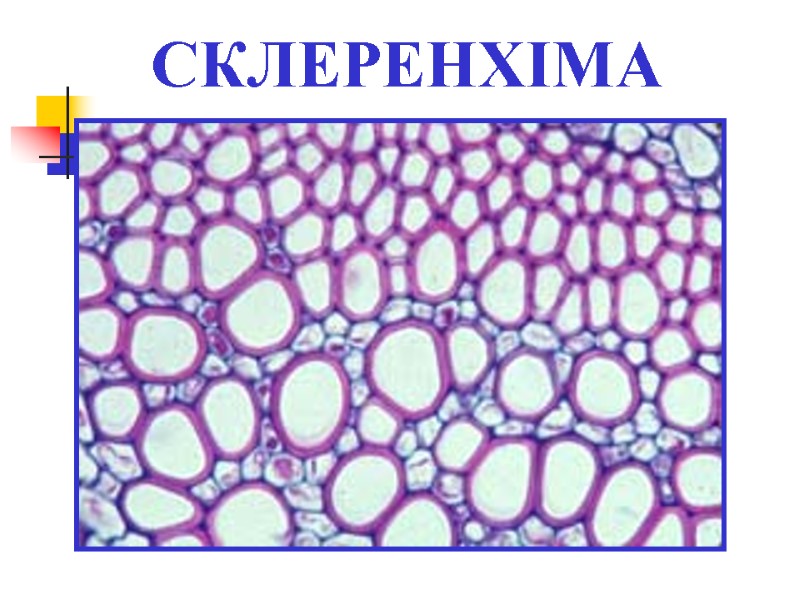 СКЛЕРЕНХІМА